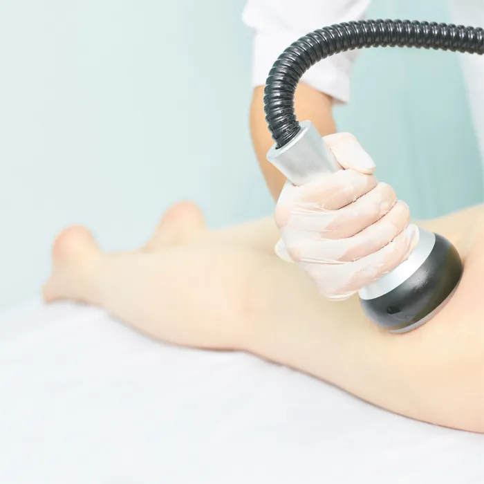 Cellulite Treatment