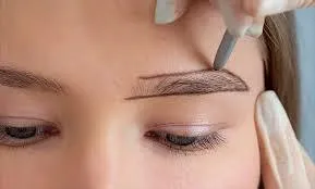 Eyebrow Transplant