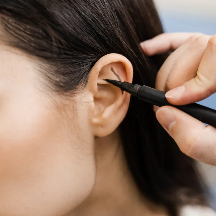 Ear Correction Surgery at DermaTales