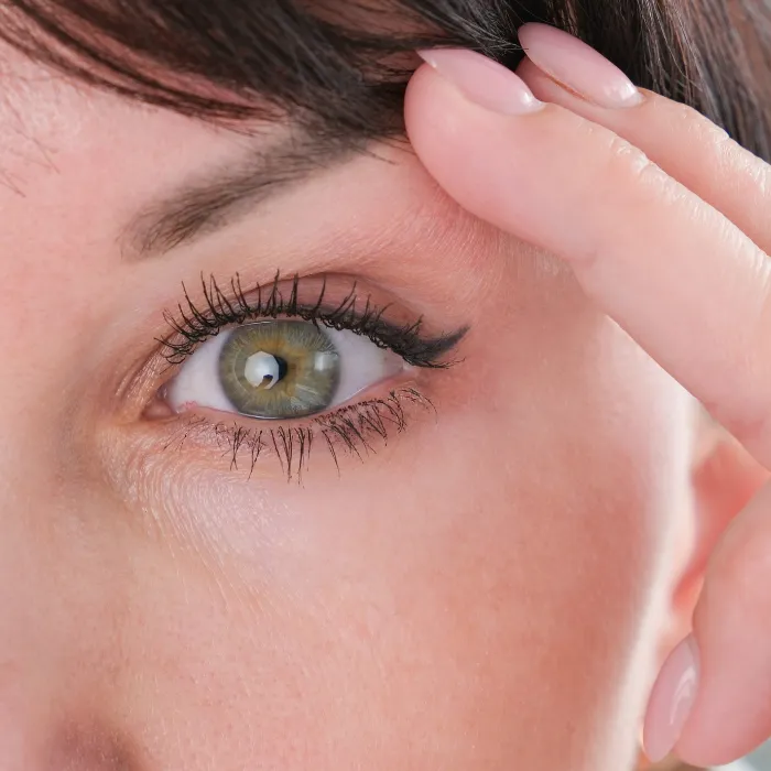 Blepharoplasty Treatment