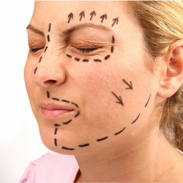 Non-Surgical Face Lifting Consultation at DermaTales