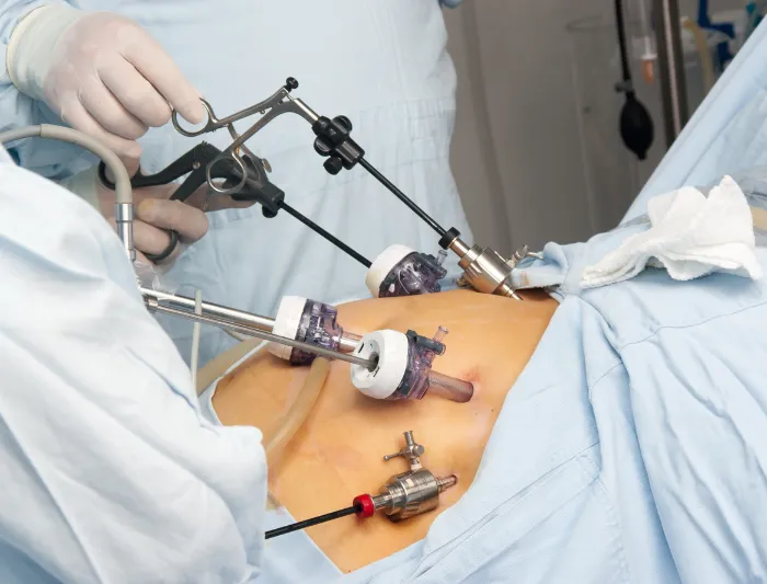 Gynaecomastia Treatment at DermaTales