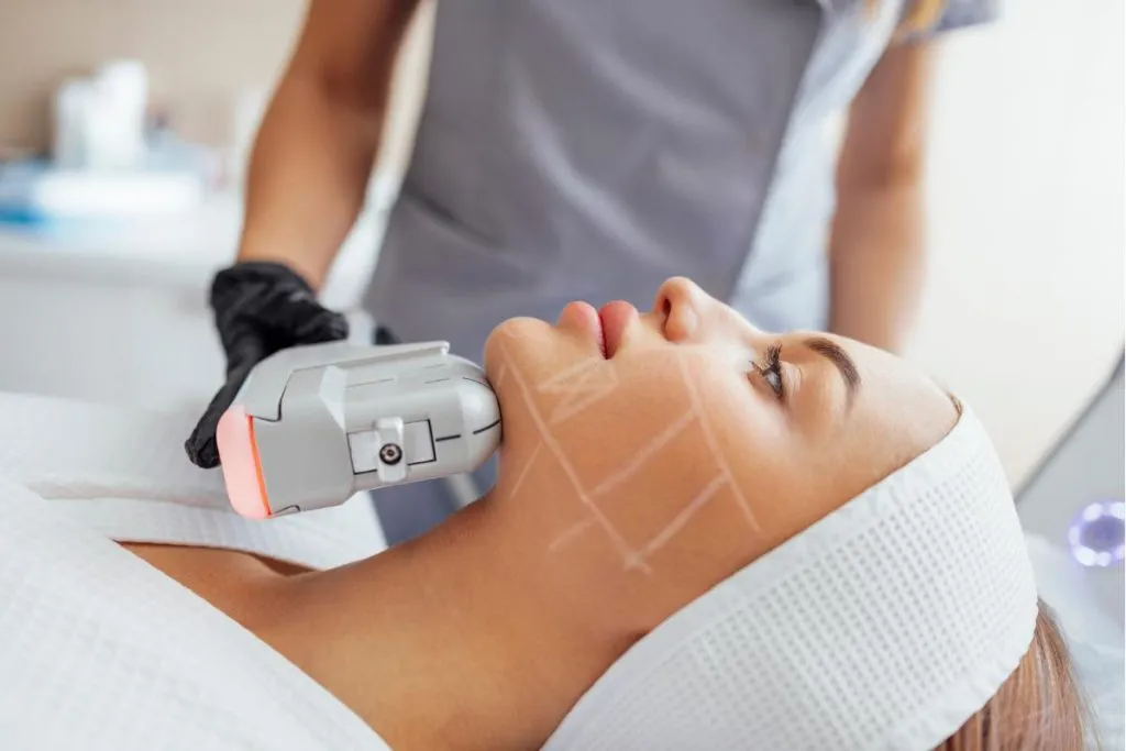 HIFU Treatment at DermaTales